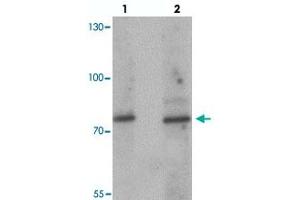 Western blot analysis of JAKMIP1 in rat brain tissue with JAKMIP1 polyclonal antibody  at (lane 1) 1 and (lane 2) 2 ug/mL. (JAKMIP1 抗体  (Internal Region))