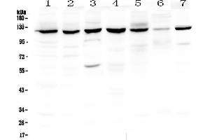 Western blot analysis of PARP using anti-PARP antibody . (PARP1 抗体  (AA 670-858))