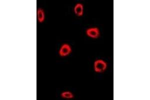 Immunofluorescent analysis of Frataxin staining in MCF7 cells. (Frataxin 抗体)