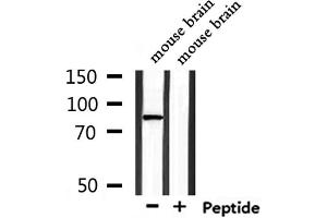 Western blot analysis of extracts from mouse brain, using TMC7 Antibody. (TMC7 抗体  (C-Term))