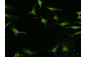 Immunofluorescence of purified MaxPab antibody to IRF5 on HeLa cell. (IRF5 抗体  (AA 1-498))