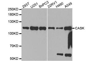 Western blot analysis of extracts of various cell lines, using CASK antibody. (CASK 抗体  (AA 1-300))