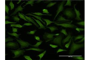 Immunofluorescence (IF) image for anti-DnaJ (Hsp40) Homolog, Subfamily B, Member 6 (DNAJB6) (AA 1-241) antibody (ABIN523422)