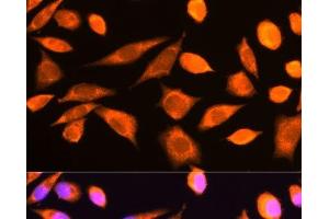 Immunofluorescence analysis of L929 cells using RPS20 Polyclonal Antibody at dilution of 1:100. (RPS20 抗体)