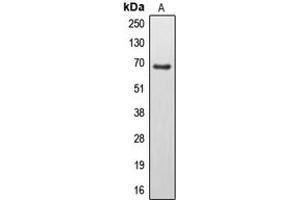 Western blot analysis of EPS8L3 expression in U251MG (A) whole cell lysates. (EPS8-Like 3 抗体  (Center))