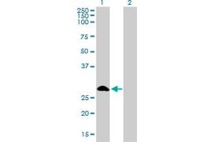 Western Blot analysis of FHL1 expression in transfected 293T cell line by FHL1 monoclonal antibody (M01), clone 2A9. (FHL1 抗体  (AA 23-120))