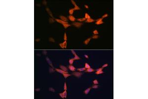 Immunofluorescence analysis of NIH-3T3 cells using PIK3R4/VPS15 Rabbit mAb (ABIN7269322) at dilution of 1:100 (40x lens). (PIK3R4 抗体)