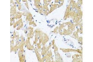 Immunohistochemistry of paraffin-embedded Rat heart using GLUT4 Polyclonal Antibody at dilution of 1:100 (40x lens). (GLUT4 抗体)