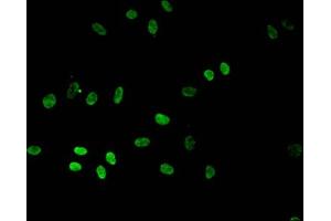 Immunofluorescence (IF) image for anti-Histone Cluster 1, H3a (HIST1H3A) (meLys4) antibody (ABIN7139601)