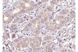 Immunohistochemistry (IHC) image for anti-Protein tyrosine Phosphatase, Non-Receptor Type 11 (PTPN11) (pTyr542) antibody (ABIN6256761)