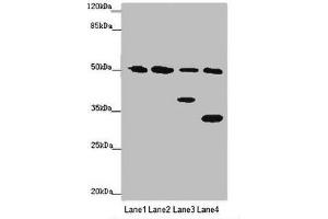 Western blot All lanes: B7H6 antibody at 2 μg/mL Lane 1: Mouse heart tissue Lane 2: Mouse liver tissue Lane 3: Mouse brain tissue Lane 4: Hela whole cell lysate Secondary Goat polyclonal to rabbit IgG at 1/10000 dilution Predicted band size: 51 kDa Observed band size: 51, 38, 32 kDa (B7-H6 抗体  (AA 25-262))