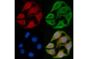 ABIN6263354 and ABIN6278592 staining Hela cells by IF/ICC. (MRGPRX4 抗体  (C-Term))