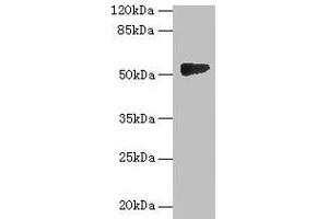 Western blot All lanes: GTDC1 antibody at 4 μg/mL + A549 whole cell lysate Secondary Goat polyclonal to rabbit IgG at 1/10000 dilution Predicted band size: 53, 44, 34, 50, 38 kDa Observed band size: 53 kDa (GTDC1 抗体  (AA 1-292))
