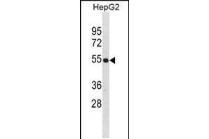 Western blot analysis in HepG2 cell line lysates (35ug/lane). (ZNF101 抗体  (AA 122-148))