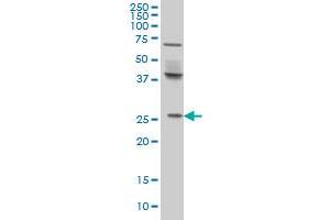 Western Blotting (WB) image for anti-PRELI Domain Containing 1 (PRELID1) (AA 3-101) antibody (ABIN599217) (PRELID1 抗体  (AA 3-101))