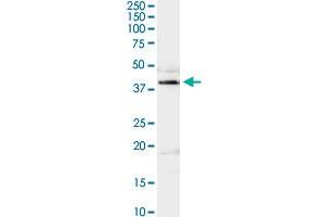ADA MaxPab rabbit polyclonal antibody. (ADA 抗体  (AA 1-363))