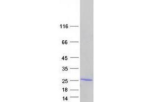 Tumor Necrosis Factor, alpha-Induced Protein 8 (TNFAIP8) (Transcript Variant 2) protein (Myc-DYKDDDDK Tag)