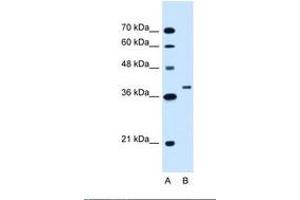 Image no. 1 for anti-Ring Finger Protein 146 (RNF146) (C-Term) antibody (ABIN320783) (RNF146 抗体  (C-Term))
