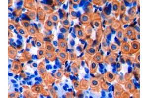 Detection of CK-BB in Mouse Stomach Tissue using Polyclonal Antibody to Creatine Kinase B (CK-BB) (CKB 抗体)