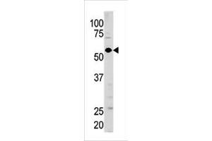 Western blot analysis of anti-GUCY1A3 Pab (ABIN391201 and ABIN2841286) in mouse brain tissue lysate (35 μg/lane). (GUCY1A1 抗体  (N-Term))