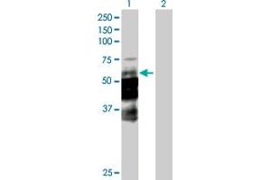 Western Blot analysis of DCP1A expression in transfected 293T cell line by DCP1A MaxPab polyclonal antibody. (DCP1A 抗体  (AA 1-582))