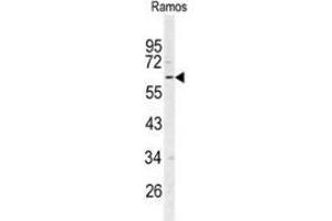 Western blot analysis of RIP3 / RIPK3 (arrow) in Ramos cell line lysates (35ug/lane) using RIPK3 / RIP3  Antibody (N-term).