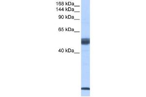 WB Suggested Anti-SF3B14 Antibody Titration:  0. (Pre-mRNA Branch Site Protein p14 (SF3B14) (Middle Region) 抗体)