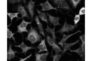 Immunofluorescent staining of HeLa cells (ATCC CCL-2). (MEK1 抗体)