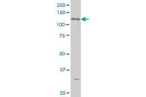 ABL2 monoclonal antibody (M09), clone 5C6 Western Blot analysis of ABL2 expression in K-562 . (ABL2 抗体  (AA 743-842))