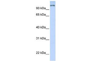 WB Suggested Anti-PAntibody Titration:  0. (PARP9 抗体  (N-Term))