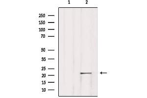 Western blot analysis of extracts from Rat lung, using TNFAIP8L1 Antibody. (TNFAIP8L1 抗体  (Internal Region))