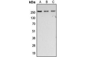 Western blot analysis of Fibronectin expression in HeLa (A), SP2/0 (B), rat lung (C) whole cell lysates. (Fibronectin 抗体  (C-Term))