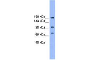 Image no. 1 for anti-ADAM Metallopeptidase with Thrombospondin Type 1 Motif, 19 (ADAMTS19) (N-Term) antibody (ABIN6746174) (ADAMTS19 抗体  (N-Term))