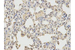 Immunohistochemistry (IHC) image for anti-Neural Wiskott-Aldrich syndrome protein (WASL) antibody (ABIN1875345) (Neural Wiskott-Aldrich syndrome protein (WASL) 抗体)