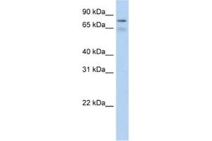 Western Blotting (WB) image for anti-Bromodomain Containing 4 (BRD4) antibody (ABIN2461848) (BRD4 抗体)
