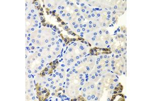 Immunohistochemistry of paraffin-embedded mouse kidney using ENDOG antibody. (Endonuclease G 抗体)