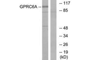 Western blot analysis of extracts from Jurkat cells, using GPRC6A Antibody. (GPRC6A 抗体  (AA 471-520))