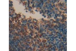 Used in DAB staining on fromalin fixed paraffin- embedded Kidney tissue (LAG3 抗体  (AA 209-451))