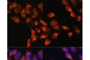 Immunofluorescence analysis of HeLa cells using C1 Inactivator Polyclonal Antibody at dilution of 1:100. (SERPING1 抗体)