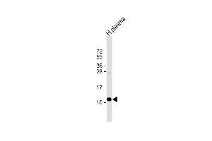 Anti-OA2 Antibody (Center) at 1:1000 dilution + human plasma lysate Lysates/proteins at 20 μg per lane. (APOA2 抗体  (AA 28-56))