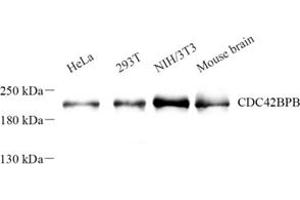Western blot analysis of Cdc42bpb (ABIN7073411) at dilution of 1: 500 (CDC42BPB 抗体)