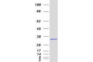 Western Blotting (WB) image for Origin Recognition Complex, Subunit 6 (ORC6) protein (Myc-DYKDDDDK Tag) (ABIN2727931)