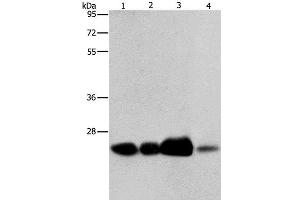 Western Blot analysis of 293T cell and Human fetal liver tissue, Human cervical cancer and fetal muscle tissue using ARFRP1 Polyclonal Antibody at dilution of 1:800 (ARFRP1 抗体)