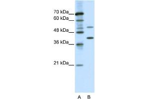 WB Suggested Anti-REXO4 Antibody Titration:  0. (REXO4 抗体  (C-Term))