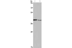 Gel: 8 % SDS-PAGE, Lysate: 40 μg, Lane 1-2: Mouse small intestine tissue, Mouse skin tissue, Primary antibody: ABIN7129190(DEGS1 Antibody) at dilution 1/450, Secondary antibody: Goat anti rabbit IgG at 1/8000 dilution, Exposure time: 5 minutes (DEGS1 抗体)