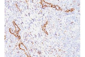Formalin-fixed, paraffin-embedded human Tonsil stained with VEGF Mouse Monoclonal Antibody (VEGF/1063). (VEGFA 抗体)