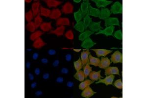 ABIN7094821 and ABIN7098872 staining Hela cells(45 min of heat-shock treatment) by IF/ICC. (GPI 抗体  (C-Term))