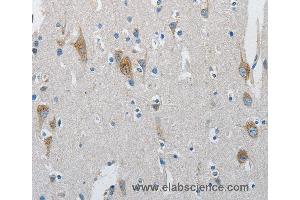 Immunohistochemistry of Human brain  using ATG4A Polyclonal Antibody at dilution of 1:30 (ATG4A 抗体)