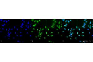 Immunocytochemistry/Immunofluorescence analysis using Rabbit Anti-Acetylated Lysine Polyclonal Antibody . (Lysine (lys) (acetylated) 抗体 (Biotin))
