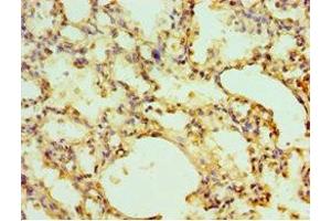 Immunohistochemistry of paraffin-embedded human lung tissue using ABIN7151442 at dilution of 1:100 (EGLN1 抗体  (AA 301-426))